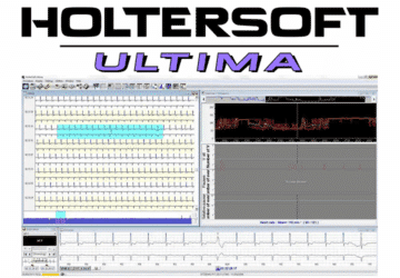 2-HolterSoft-ultima-affichage-logiciel_cpap-store.ci_.png