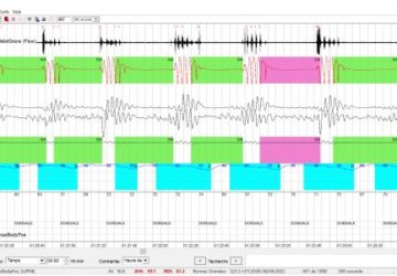 2-lecture-logiciel-medibyte_cpap-store.ci_.jpg